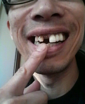 誤診?