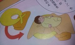 赤ちゃんの頭のゆがみの原因は?