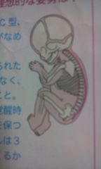 赤ちゃんの頭のゆがみの原因は?