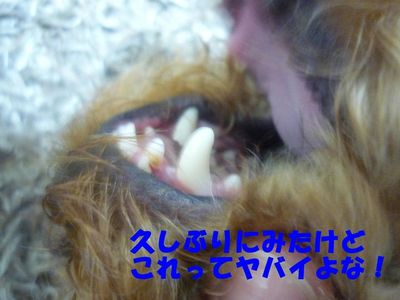歯磨き&歯石?!