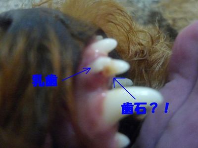 歯磨き&歯石?!