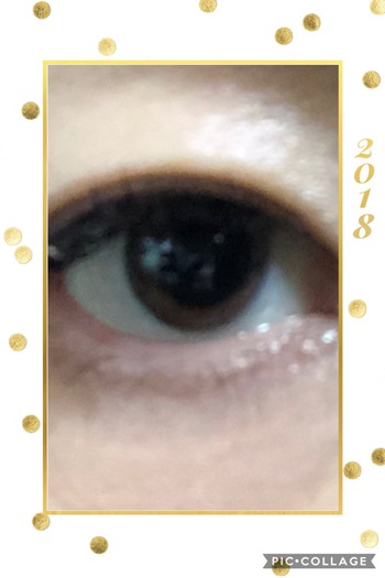 検査